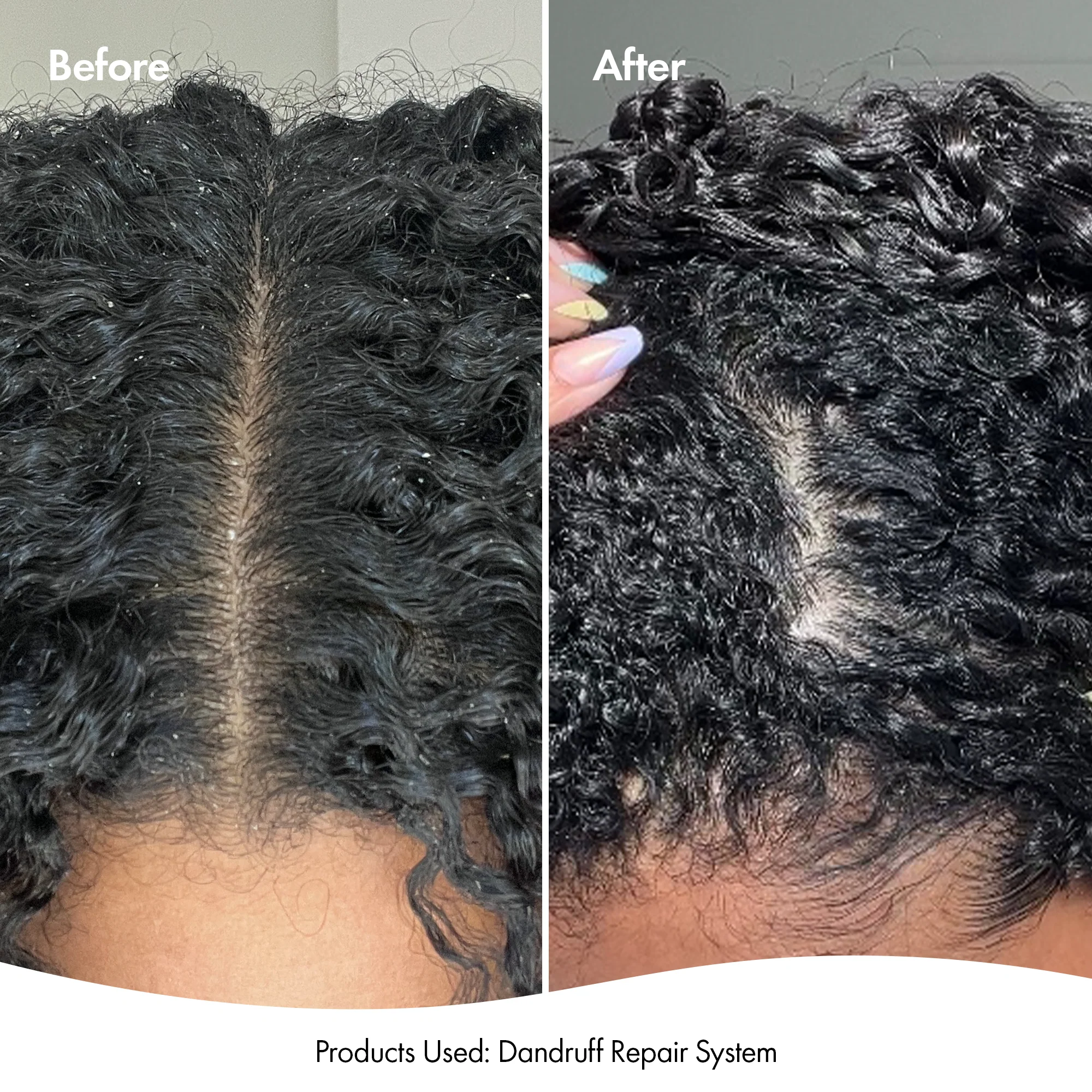 DANDRUFF CONDITIONER - Image 9