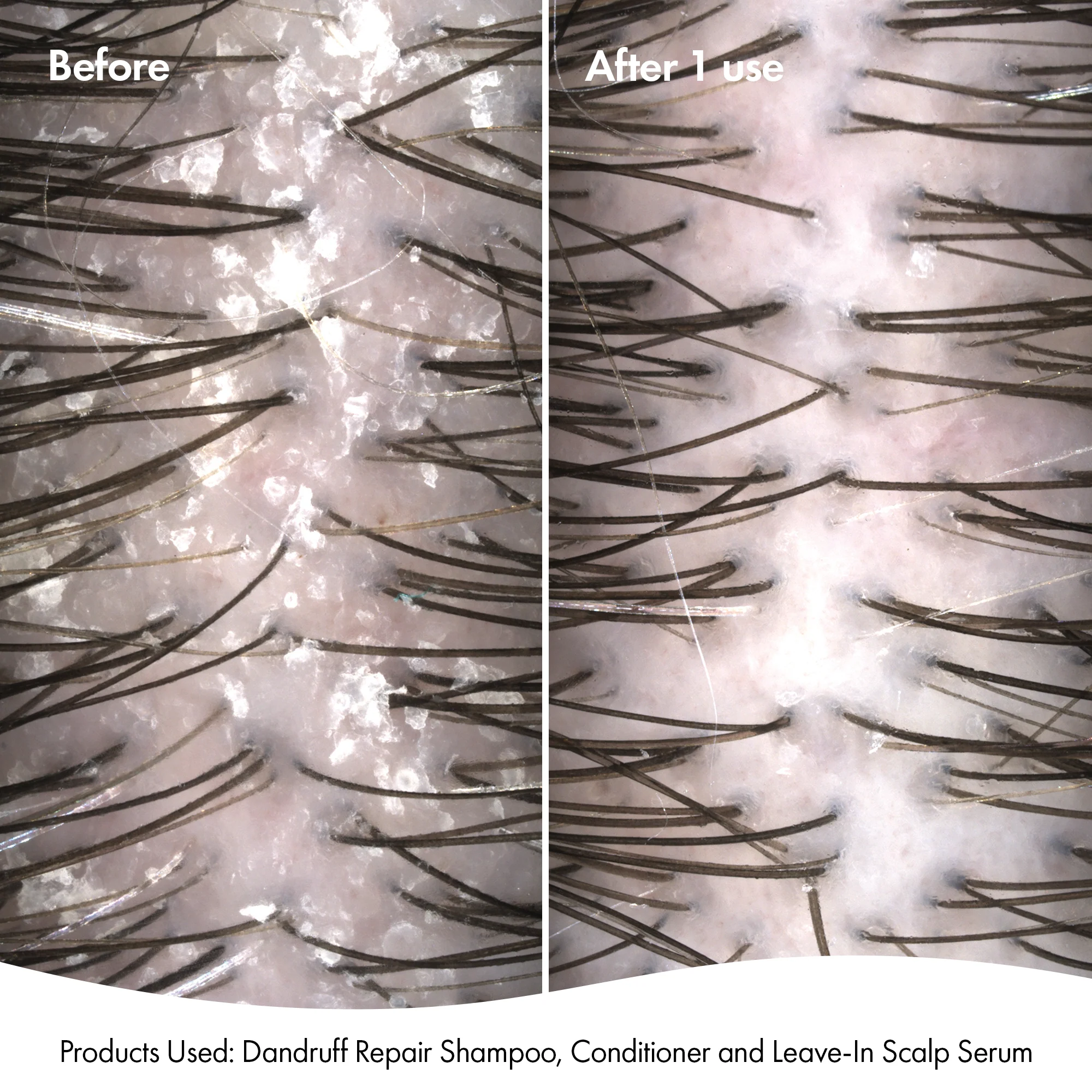 DANDRUFF CONDITIONER - Image 5