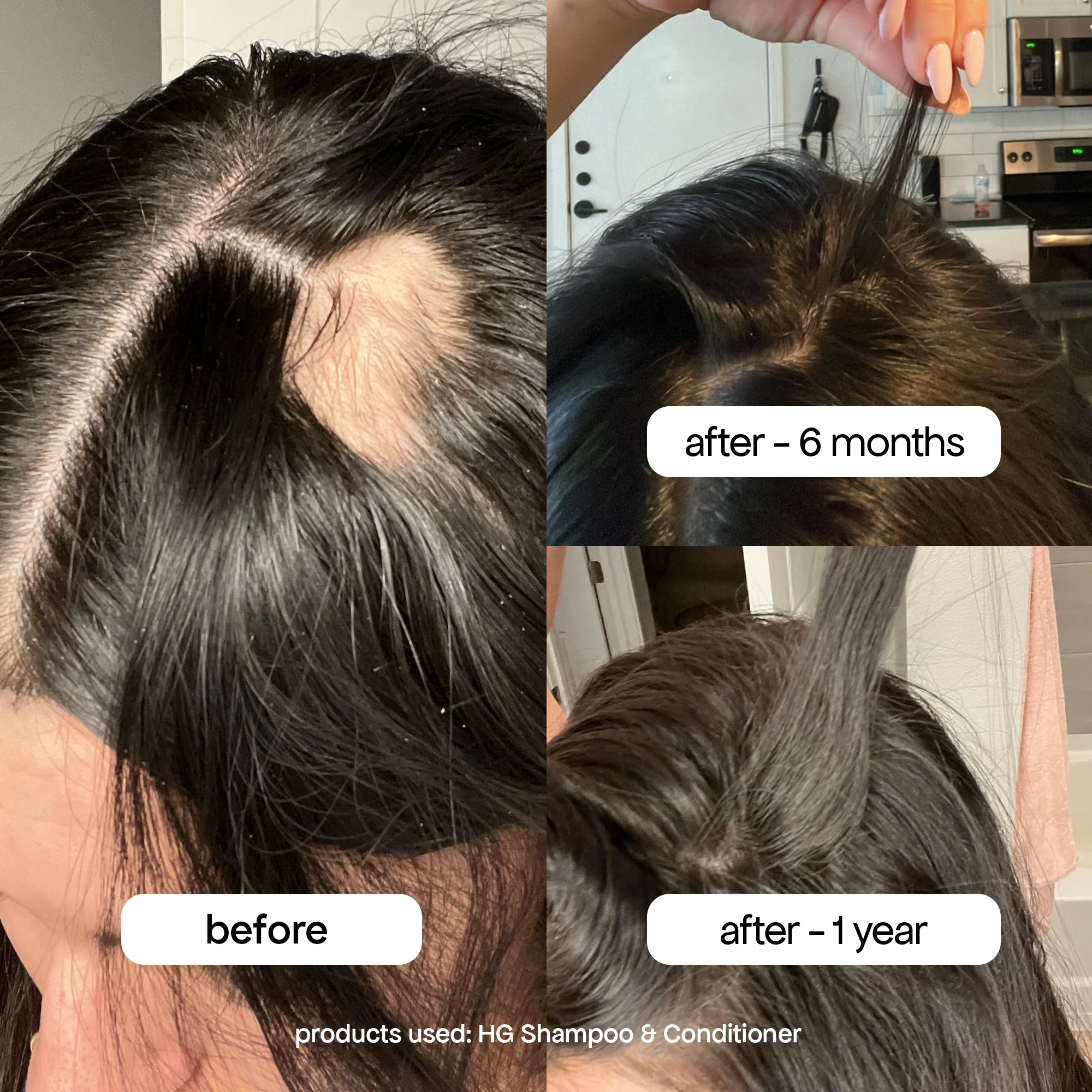 ANTI-THINNING SHAMPOO & CONDITIONER DUO - Image 4
