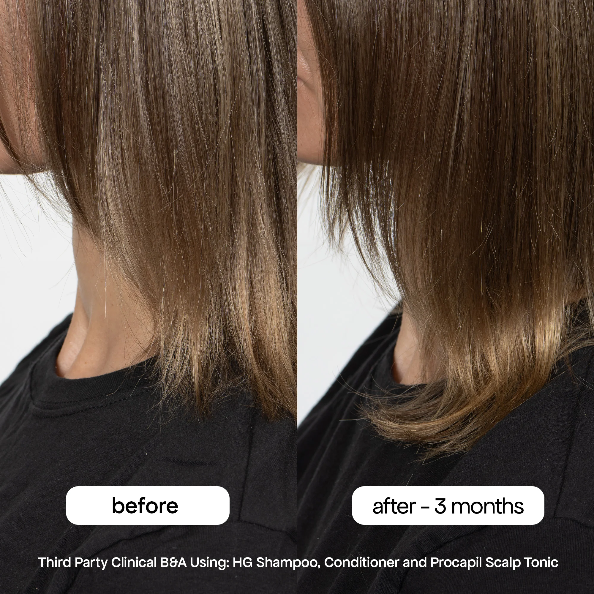 ANTI-THINNING SHAMPOO & CONDITIONER DUO - Image 11