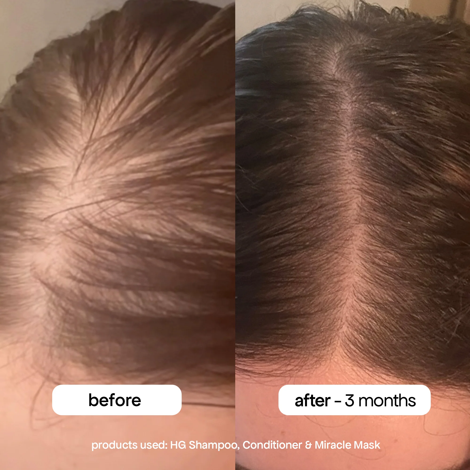 ANTI-THINNING SHAMPOO & CONDITIONER DUO - Image 5