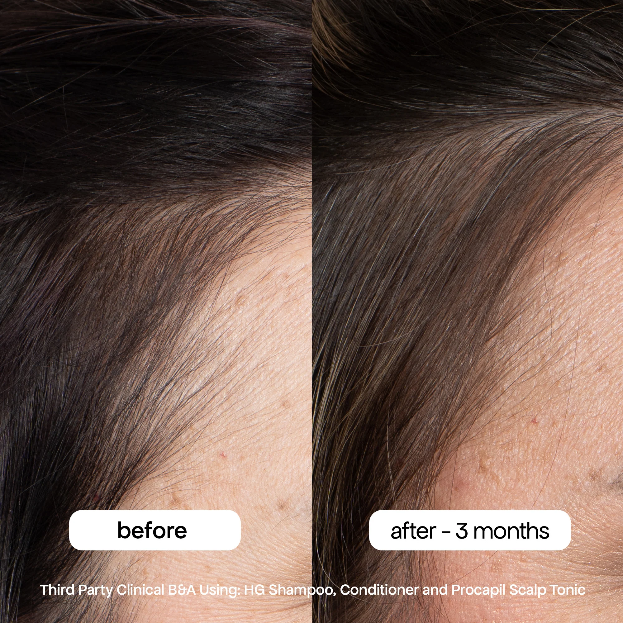 ANTI-THINNING CONDITIONER - Image 5